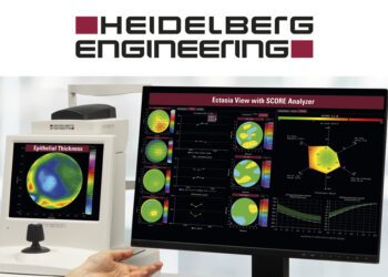 Conozca las nuevas funciones de ANTERION®