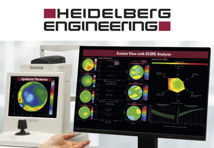 Conozca las nuevas funciones de ANTERION®