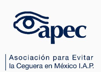 Queratotomía radial y LASIK: Un desafío en la cirugía de catarata con una sorpresa refractiva