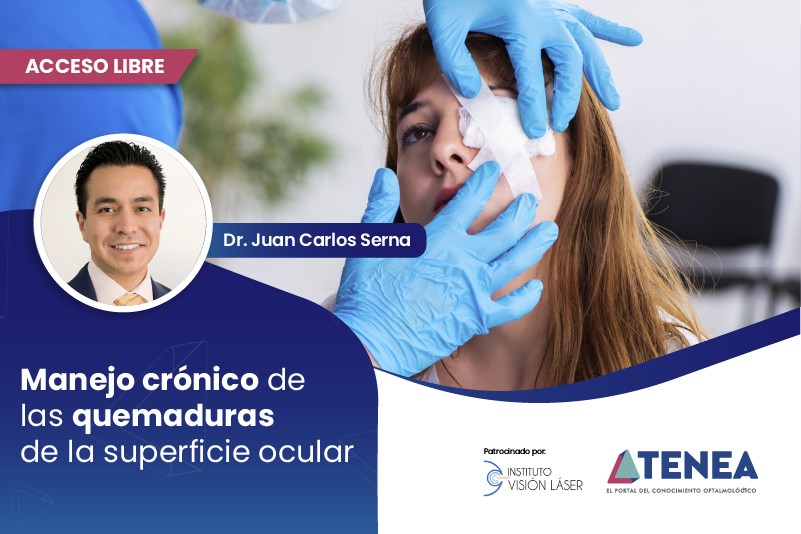 manejo cronico de las quemaduras de la superficie ocular 1 acceso libre