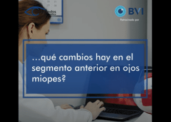 Cambios del segmento anterior en ojos miopes