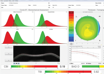 Inteligencia artificial para el especialista en córnea