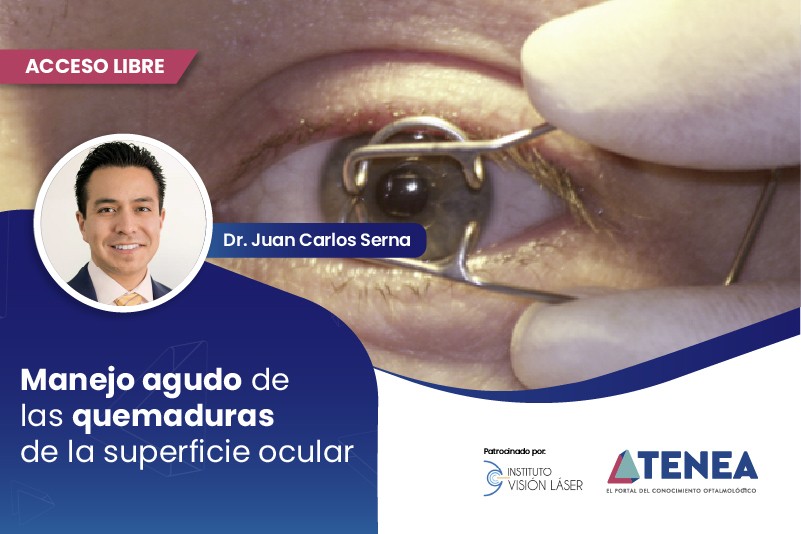 img manejo agudo de las quemaduras de la superficie ocular web acceso libre