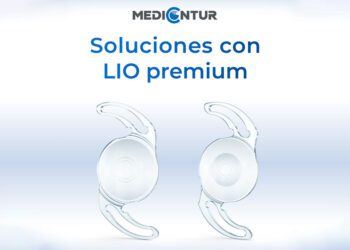 Medicontur desarrolló la tecnología Wavefront Linking