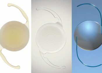 Un repaso a la cirugía facorefractiva