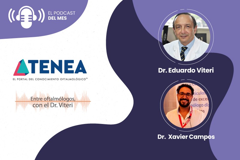 migs en glaucoma dr. xavier 800x533 web