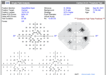 Seguimiento de la progresión del glaucoma: lo aprobado, lo verdadero y lo nuevo
