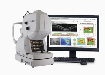Detectando Glaucoma con OCT