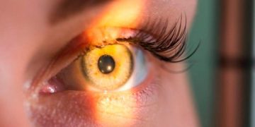 Manejo de la RDNP severa: opciones Anti-VEGF y más