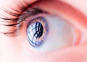 La relación catarata/estrabismo