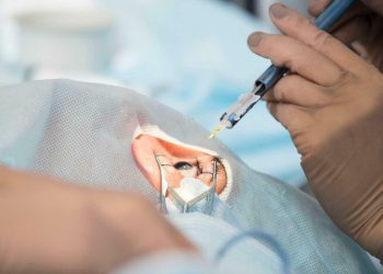 Lecciones sobre la extracción de cristalino transparente