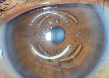 FORO NOTICIERO ALACCSA-R