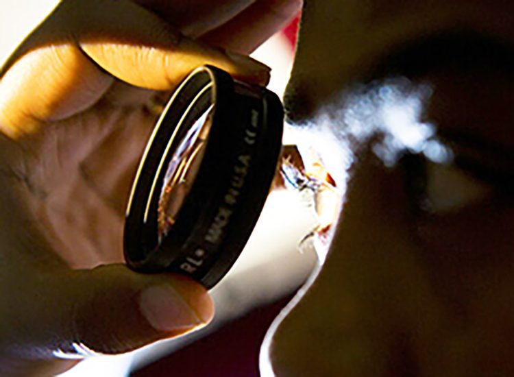 Un nuevo estudio revela cómo la IA puede ayudar a detectar la retinopatía diabética en niños y adultos jóvenes