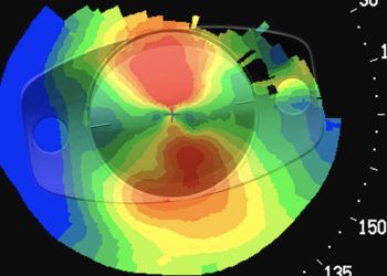 Asegurar la felicidad premium del paciente