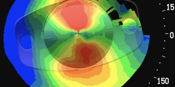 Asegurar la felicidad premium del paciente