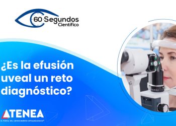 Efusión uveal, un reto diagnóstico