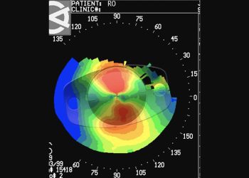 Asegurar la felicidad premium del paciente