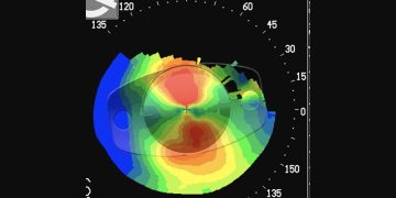 Asegurar la felicidad premium del paciente