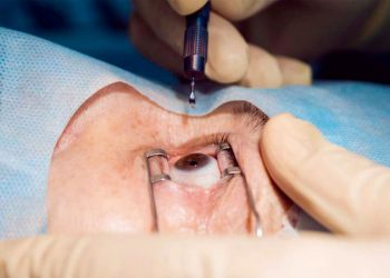 TOP TEN Manejo del TASS