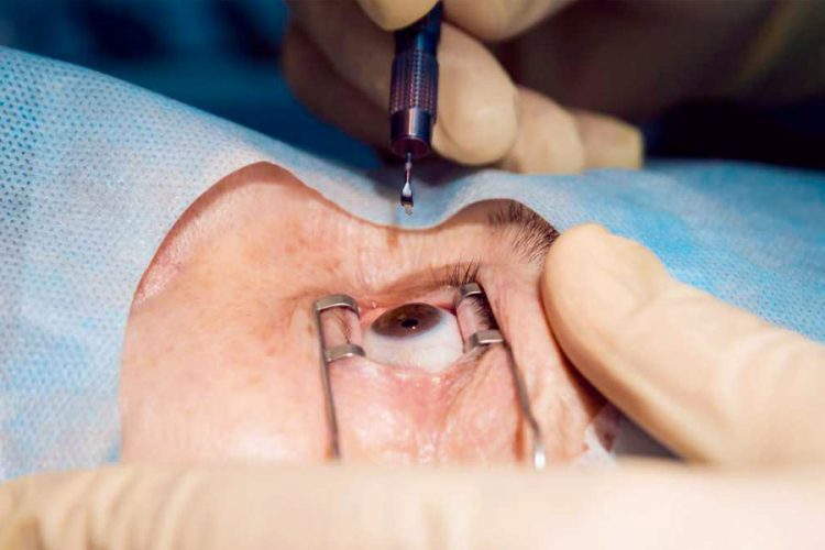 TOP TEN Manejo del TASS