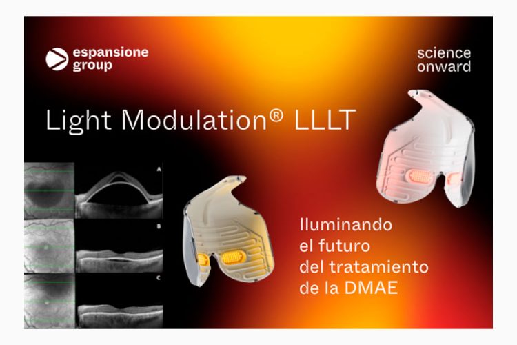 ¡Únete a la vanguardia de la salud visual con Espansione Group!