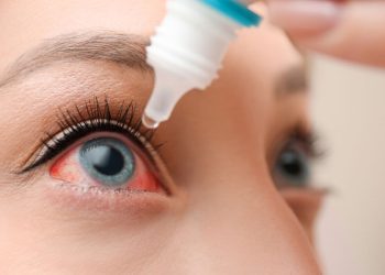 Pseudodrusen reticular: característica de riesgo macular para la progresión tardía de la DMAE