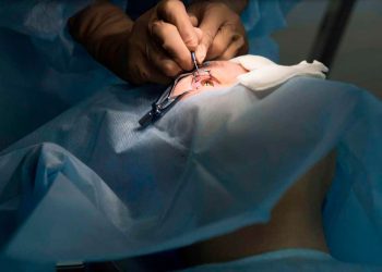 ¿Es bueno su nomograma?