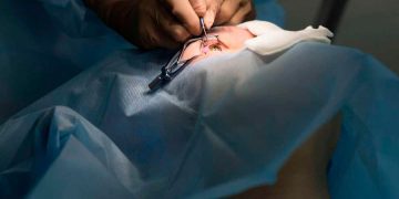 ¿Es bueno su nomograma?