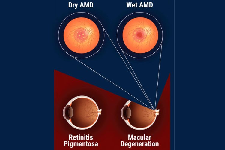 Ensayos clínicos de terapia celular: Una actualización