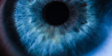 Quimioembolización intravascular con Mitomicina C: Una nueva terapia para tratar la neovascularización corneal