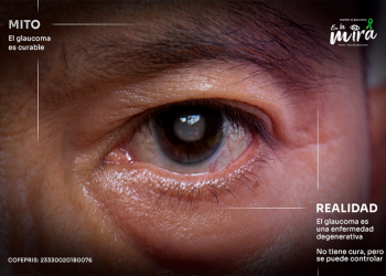 Avances en el tratamiento del glaucoma: enfoques farmacológicos y consideraciones clínicas