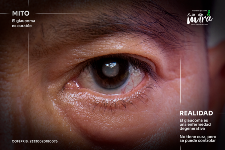 Avances en el tratamiento del glaucoma: enfoques farmacológicos y consideraciones clínicas