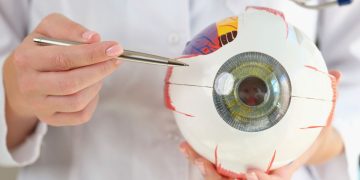 Queratoprótesis Lucia:innovación, éxito funcional y desafíos clínicos