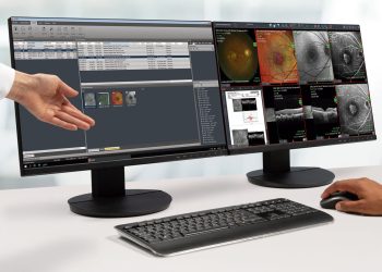 HEYEX 2: Diseñado para el futuro del cuidado de la visión