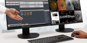 HEYEX 2: Diseñado para el futuro del cuidado de la visión