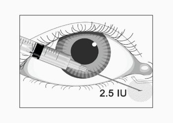 El bótox puede suponer un nuevo avance en el tratamiento del ojo seco