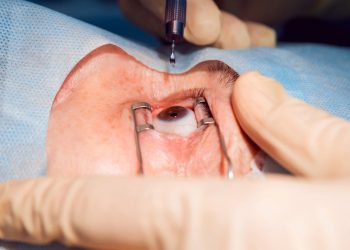 Cómo afrontar vitrectomías anteriores no planificadas