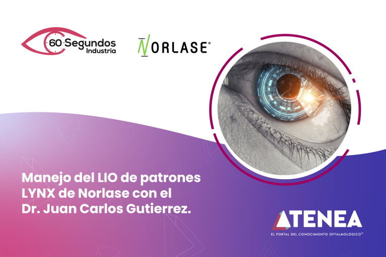 60 segundos industria manejo del lio 800x533 pag aterrizaje (1)