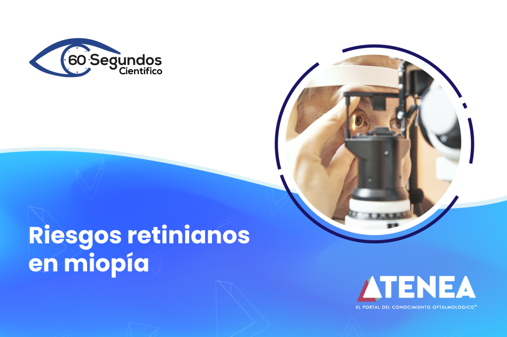 60 segundos riesgos retinianos 800x533 pag aterrizaje