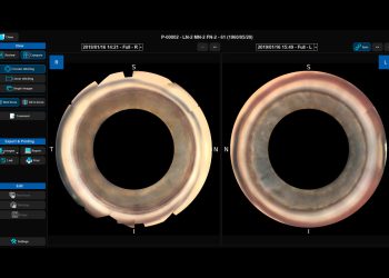 NIDEK lanza el visor GS para NAVIS-EX