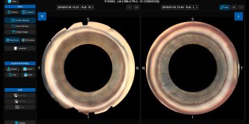 NIDEK lanza el visor GS para NAVIS-EX