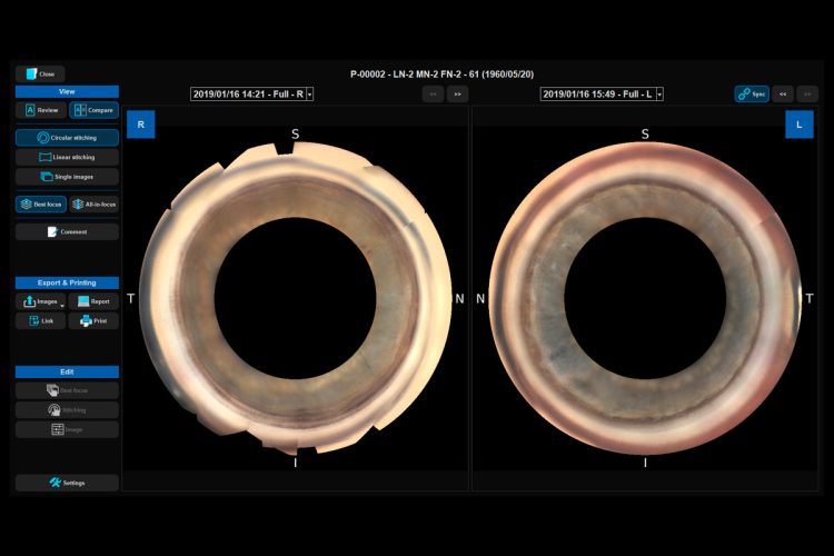 NIDEK lanza el visor GS para NAVIS-EX