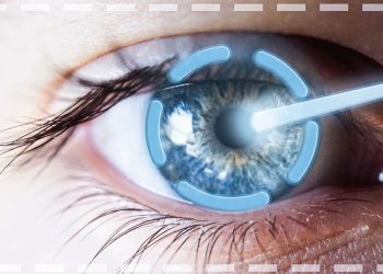 Glaucoma secundario a cirugía vítreorretinal con aceite de silicón