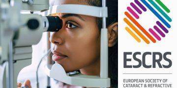 Estudio confirma que la cirugía láser para miopía es segura y eficaz en adolescentes