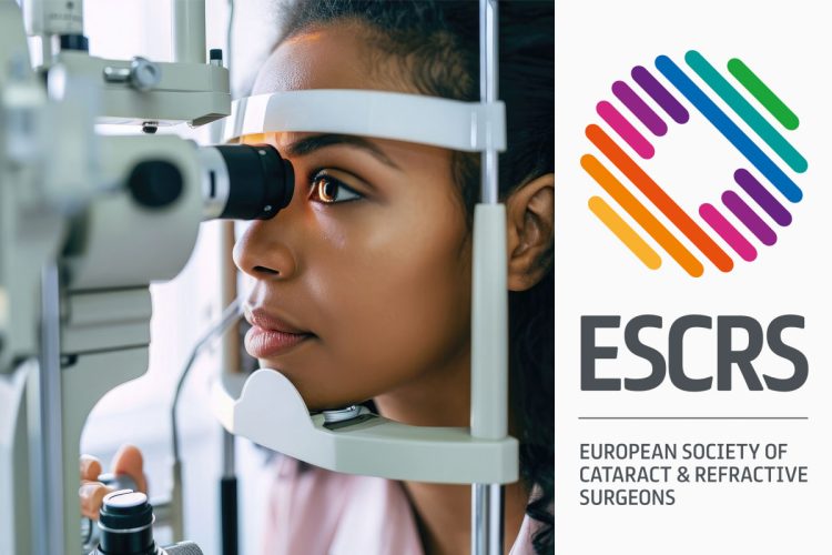 Estudio confirma que la cirugía láser para miopía es segura y eficaz en adolescentes