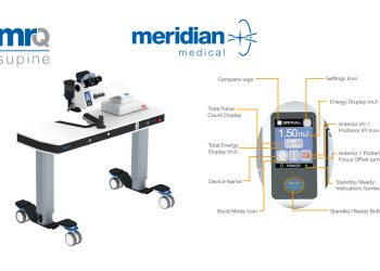 El láser Nd:YAG MR Q Supine: innovación en tratamientos oftálmicos en posición supina