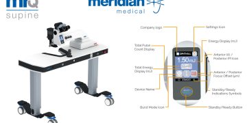 El láser Nd:YAG MR Q Supine: innovación en tratamientos oftálmicos en posición supina