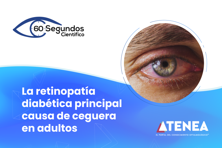 La retinopatía diabética principal causa de ceguera en adultos