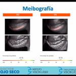 09galeria nota4 110226 oald