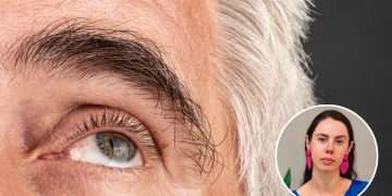 Eficacia de Latanoprosteno Bunod como Monoterapia Inicial en Glaucoma Secundario a Pseudoexfoliación
